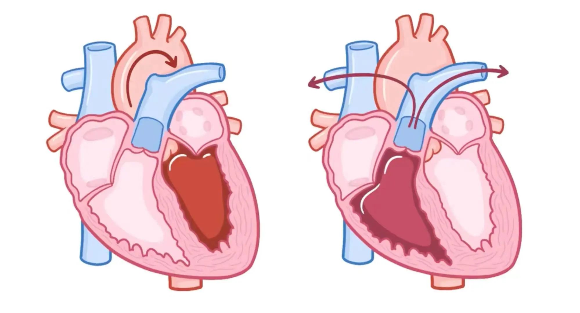 生理学——心动周期