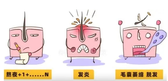 毛囊炎如何治疗、保养与预防?
