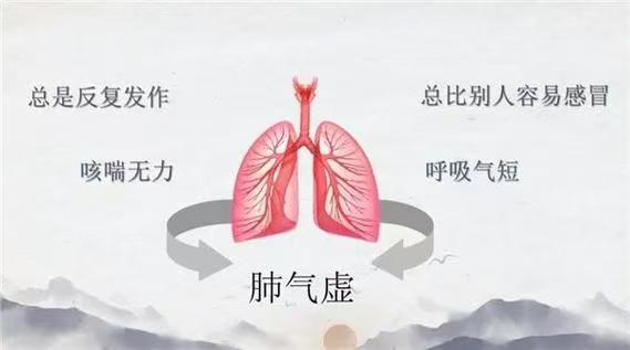 肺气虚:从理论到实践的全面指南